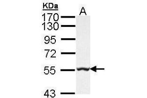 WB Image Sample (30 ug of whole cell lysate) A: Hep G2 , 7. (GLYCTK Antikörper)