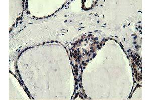Immunohistochemical staining of paraffin-embedded Human liver tissue using anti-L1CAM mouse monoclonal antibody. (L1CAM Antikörper)