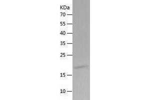 Western Blotting (WB) image for Leukemia Inhibitory Factor (LIF) (AA 23-202) protein (His tag) (ABIN7123756)