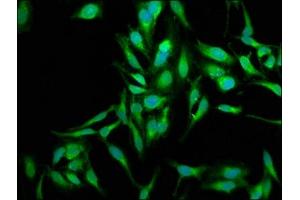 Immunofluorescence staining of Hela cells with ABIN7170983 at 1:250, counter-stained with DAPI. (SOD2 Antikörper  (AA 64-175))