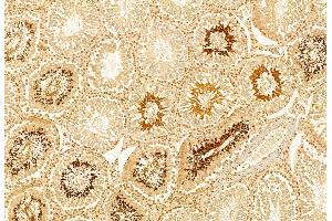 ABIN6262477 and ABIN6272870 at 1/100 staining Rat testis tissue by IHC-P. (IFT140 Antikörper  (Internal Region))