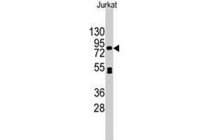 Western blot analysis of CDH12 polyclonal antibody  in Jurkat cell line lysates (35 ug/lane). (Cadherin 12 Antikörper  (N-Term))