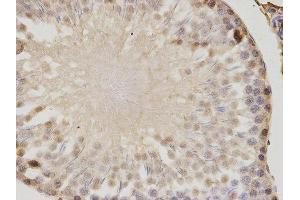 Immunohistochemistry (IHC) image for anti-Proteasome (Prosome, Macropain) Activator Subunit 1 (PA28 Alpha) (PSME1) antibody (ABIN1876546) (PSME1 Antikörper)