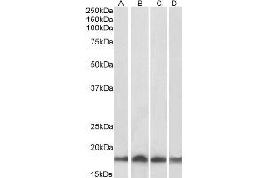 Western Blotting (WB) image for anti-Ubiquitin-Conjugating Enzyme E2L 3 (UBE2L3) antibody (ABIN5894613) (UBE2L3 Antikörper)