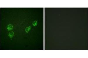Immunofluorescence analysis of HuvEc cells, using PLB (Phospho-Ser16+Thr17) Antibody. (Phospholamban Antikörper  (pSer16))
