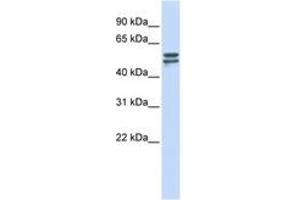 Image no. 1 for anti-Glucose-6-Phosphate Dehydrogenase (G6PD) (AA 180-229) antibody (ABIN6744275) (Glucose-6-Phosphate Dehydrogenase Antikörper  (AA 180-229))