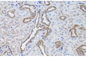 Immunohistochemistry of paraffin-embedded Rat kidney using ITGAV Polyclonal Antibody at dilution of 1:50 (40x lens). (CD51 Antikörper)