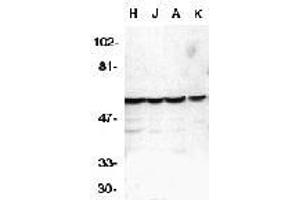 Western blot analysis of caspase-10 in HeLa (H), Jurkat (J), A431 (A), K562 (K) whole cell lysates with AP30189PU-N Caspase-10 antibody at 1 μg/ml. (Caspase 10 Antikörper  (C-Term))
