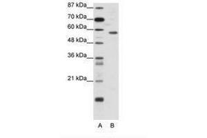 Image no. 1 for anti-YY1 Transcription Factor (YY1) (N-Term) antibody (ABIN6736135) (YY1 Antikörper  (N-Term))