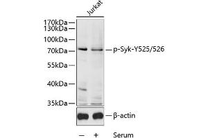 Western blot analysis of extracts of Jurkat cells, using Phospho-Syk-Y525/526 antibody (ABIN6135327, ABIN6136270, ABIN6136271 and ABIN6225570) at 1:1000 dilution. (SYK Antikörper  (pTyr525, pTyr526))