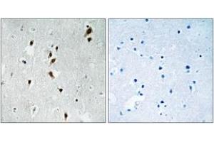 Immunohistochemistry analysis of paraffin-embedded human brain, using Mnk1 (Phospho-Thr385) Antibody. (MKNK1 Antikörper  (pThr385))