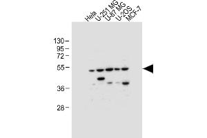 All lanes : Anti-DFNA5 Antibody (N-term) at 1:1000 dilution Lane 1: Hela whole cell lysate Lane 2: U-251 MG whole cell lysate Lane 3: U-87 MG whole cell lysate Lane 4: U-2OS whole cell lysate Lane 5: MCF-7 whole cell lysate Lysates/proteins at 20 μg per lane. (DFNA5 Antikörper  (N-Term))