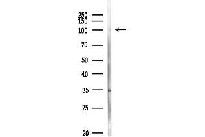 Western blot analysis of lysates from MDA-MB-231 cells(heat-shock,45 min treatment), using Rad21 Antibody at 1/1000 dilution.
