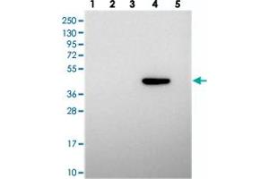 Western blot analysis of Lane 1: RT-4, Lane 2: U-251 MG, Lane 3: Human Plasma, Lane 4: Liver, Lane 5: Tonsil with PRDM12 polyclonal antibody  at 1:250-1:500 dilution. (PRDM12 Antikörper)
