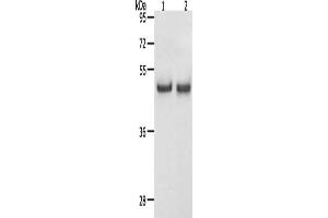 Gel: 12 % SDS-PAGE, Lysate: 40 μg, Lane 1-2: Hela cells, K562 cells, Primary antibody: ABIN7192614(SPAG4 Antibody) at dilution 1/1100, Secondary antibody: Goat anti rabbit IgG at 1/8000 dilution, Exposure time: 30 seconds (SPAG4 Antikörper)