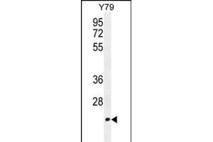 TCAL3 Antibody (N-term) (ABIN654479 and ABIN2844214) western blot analysis in Y79 cell line lysates (35 μg/lane).