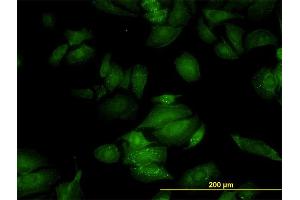 Immunofluorescence of monoclonal antibody to RGL2 on HeLa cell. (RGL2 Antikörper  (AA 644-743))