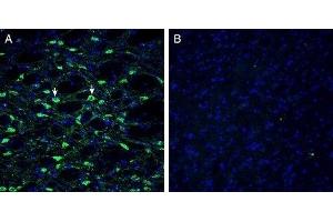 Expression of Histamine H1 Receptor in mouse substantia nigraImmunohistochemical staining of perfusion-fixed frozen mouse brain sections with Anti-Histamine H1 Receptor/HRH1 Antibody (extracellular) (ABIN7043269, ABIN7044512 and ABIN7044513), (1:300), followed by goat anti-rabbit-AlexaFluor-488. (Histamine Receptor H1 (HRH1) Peptid)