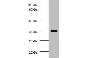 Western blot All lanes: Serine/threonine-protein phosphatase 2A catalytic subunit beta isoform Antibody at 2 μg/mL + EC109 whole cell lysate Secondary Goat polyclonal to rabbit IgG at 1/15000 dilution Predicted band size: 34 kDa Observed band size: 34 kDa (PPP2CB Antikörper  (Catalytic Subunit beta))