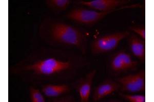 Immunofluorescence staining of methanol-fixed HeLa cells using NF-kappa,B p100(phospho-Ser870) antibody. (NFKB2 Antikörper  (pSer870))