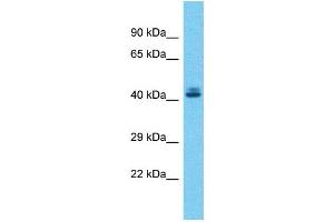 Host:  Rabbit  Target Name:  ZSCAN5A  Sample Type:  Liver tumor lysates  Antibody Dilution:  1. (ZSCAN5A Antikörper  (C-Term))