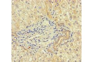 Immunohistochemistry of paraffin-embedded human liver tissue using ABIN7168083 at dilution of 1:100 (RIBC1 Antikörper  (AA 1-200))