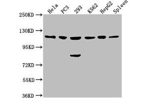 Western Blot Positive WB detected in: Hela whole cell lysate, PC3 whole cell lysate, 293 whole cell lysate, K562 whole cell lysate, HepG2 whole cell lysate, Rat spleen tissue All lanes: CDKL5 antibody at 1:2000 Secondary Goat polyclonal to rabbit IgG at 1/50000 dilution Predicted band size: 116, 108 kDa Observed band size: 116 kDa (CDKL5 Antikörper  (AA 790-921))