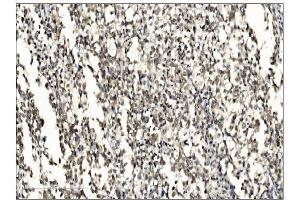 IHC analysis of SUMO2/3 using anti-SUMO2/3 antibody (ABIN7600856). (SUMO2/3 Antikörper  (AA 24-72))