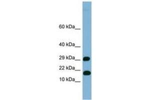 Image no. 1 for anti-TRAPPC2L (N-Term) antibody (ABIN6741901) (TRAPPC2L Antikörper  (N-Term))