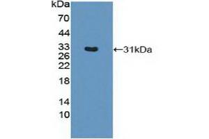Western Blotting (WB) image for anti-Major Histocompatibility Complex, Class II, DR beta 1 (HLA-DRB1) (AA 27-264) antibody (ABIN7440767)