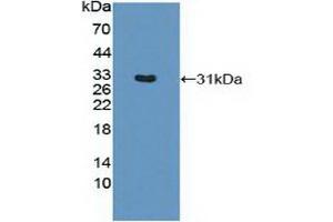 Detection of Recombinant MHCDRb1, Mouse using Polyclonal Antibody to HLA Class II Histocompatibility Antigen, DRB1 Beta Chain (HLA-DRB1) (HLA-DRB1 Antikörper  (AA 27-264))
