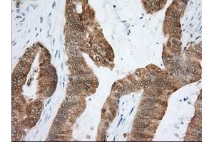 Immunohistochemical staining of paraffin-embedded Human liver tissue using anti-ACAT2 mouse monoclonal antibody. (ACAT2 Antikörper)