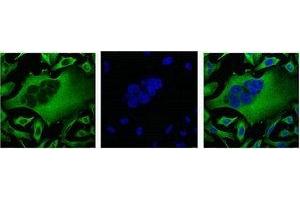IF analysis of Hela with β-Tubulin Monoclonal Antibody(Left) and DAPI (Right) diluted at 1:100. (TUBB3 Antikörper)