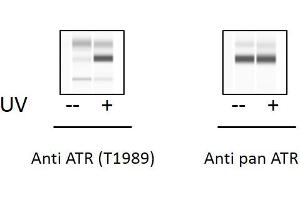 T47D cells were untreated or treated with UV. (ATR ELISA Kit)