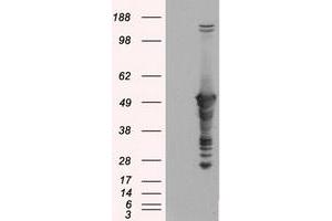 Image no. 1 for anti-Glial Fibrillary Acidic Protein (GFAP) antibody (ABIN1498437) (GFAP Antikörper)