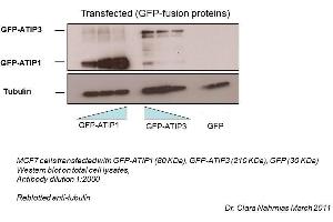 Western Blotting (WB) image for anti-Microtubule Associated Tumor Suppressor 1 (MTUS1) (Middle Region) antibody (ABIN2781855)