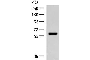 Western blot analysis of Mouse skeletal muscle tissue lysate using MYOT Polyclonal Antibody at dilution of 1:900 (Myotilin Antikörper)