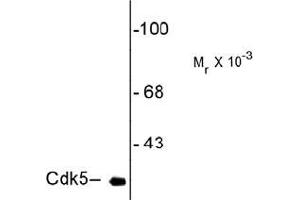 Western Blotting (WB) image for anti-Cyclin-Dependent Kinase 5 (CDK5) antibody (ABIN782438) (CDK5 Antikörper)