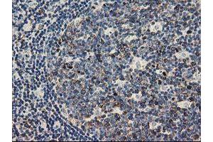 Immunohistochemical staining of paraffin-embedded Human lymph node tissue using anti-TACC3 mouse monoclonal antibody.