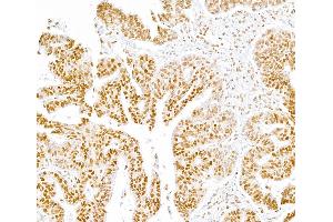 Immunohistochemistry (IHC) image for anti-RNA Polymerase II (pSer5) antibody (ABIN7455032) (RNA Polymerase II Antikörper  (pSer5))