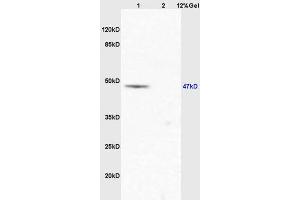 Lane 1: mouse lung lysates Lane 2: mouse stomach lysates probed with Anti EIF5 Polyclonal Antibody, Unconjugated (ABIN1387374) at 1:200 in 4 °C. (EIF5 Antikörper  (AA 331-431))