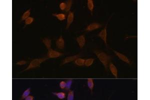 Immunofluorescence analysis of NIH-3T3 cells using NDUFA5 Polyclonal Antibody at dilution of 1:100 (40x lens). (NDUFA5 Antikörper)