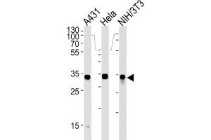 Western Blotting (WB) image for anti-Malate Dehydrogenase 2, NAD (Mitochondrial) (MDH2) antibody (ABIN3001706) (MDH2 Antikörper)