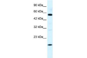 Human HepG2; WB Suggested Anti-ZNF436 Antibody Titration: 1. (ZNF436 Antikörper  (N-Term))