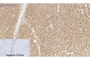 Immunohistochemical analysis of paraffin-embedded human liver tissue. (Catalase Antikörper  (C-Term))