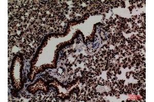 Immunohistochemistry (IHC) analysis of paraffin-embedded Mouse Lung, antibody was diluted at 1:100. (FOXP1 Antikörper  (C-Term))