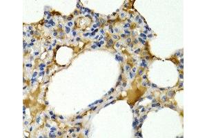 Immunohistochemistry of paraffin-embedded Rat lung using IL9 Polyclonal Antibody at dilution of 1:200 (40x lens). (IL-9 Antikörper)