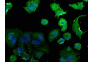 Immunofluorescence staining of MCF-7 cells with ABIN7139755 at 1:50, counter-stained with DAPI. (CAMK2N2 Antikörper  (AA 10-28))