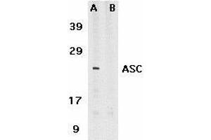 Immunocytochemistry of ASC in HL60 cells with ASC antibody at 5μg/ml. (PYCARD Antikörper  (C-Term))