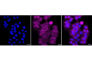Immunocytochemical staining of HepG2 cells with pan Cadherin antibody (ABIN7797823), 1:1,000). (Rekombinanter Cadherin pan Antikörper)